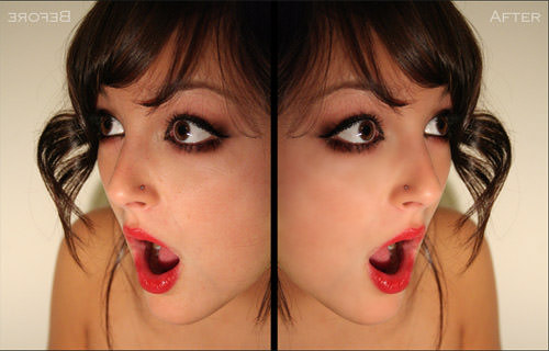 Skin Smoothing